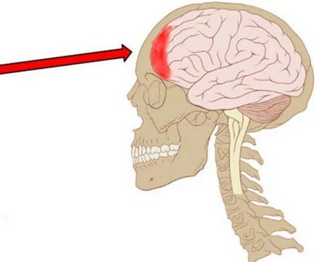 Сильно болит лобная часть головы что