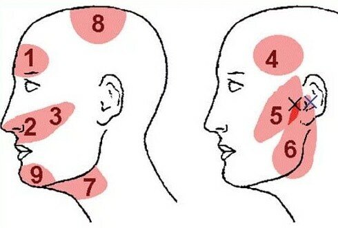 Болят виски сильно болит голова
