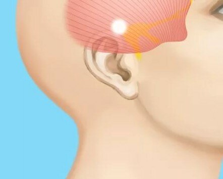 Болит правая часть головы и правый глаз и висок что это