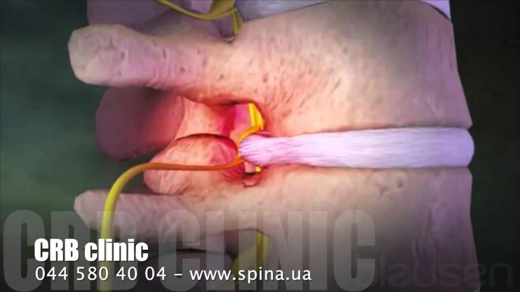 Что может быть когда болит спина снизу