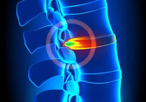 Болит спина под лопатками шея