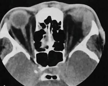 Болит спина и невысокая температура что это такое