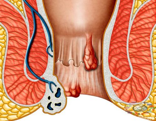 Болят бока с двух сторон со спины что это