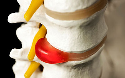 Не могу спать болит спина в грудном отделе