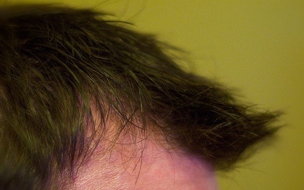 стильная причёска боли в лобной части