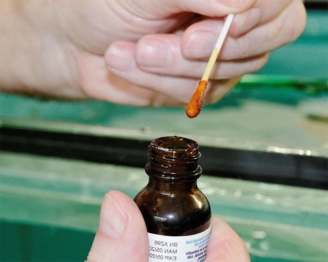 Участок спины обеззараживается йодом