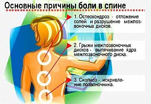 Основные причины боли в спине Основные причины боли в спине