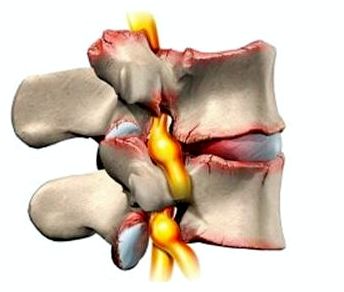 Не могу спать болит спина в грудном отделе