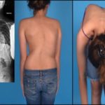 Болит в области грудной клетки и отдает в спину