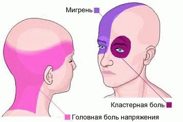 болит голова обезболивающие не помогают почему