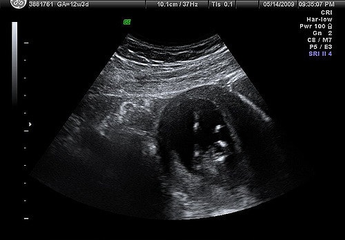 человеческий орган тотальное обследование