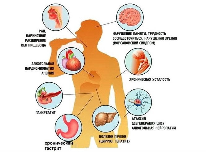 Влияние алкоголя на органы Влияние алкоголя на органы