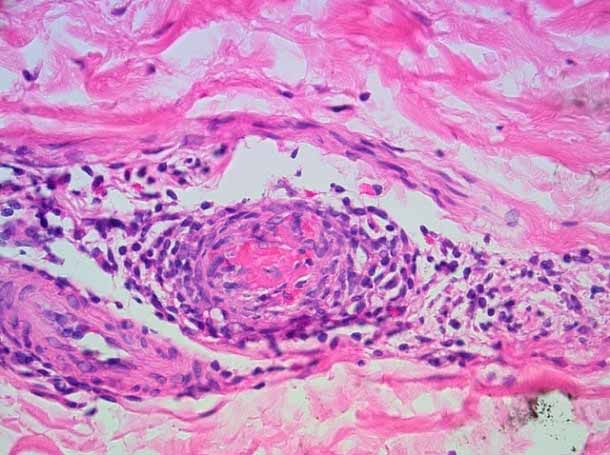 круговорот крови маленькие частички